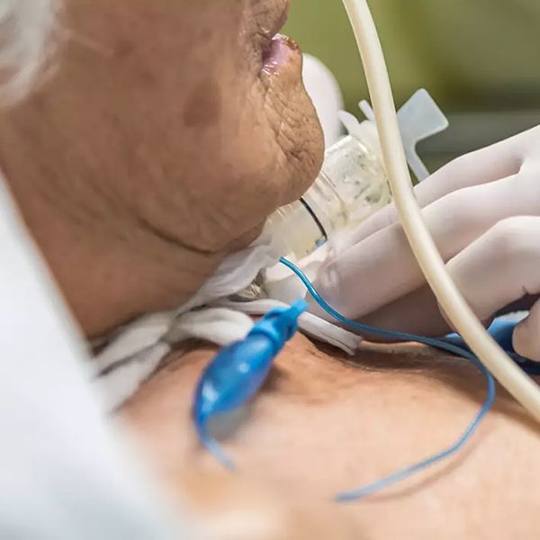 Gestione paziente tracheostomizzato e con supporto ventilatorio | Edizione I.24