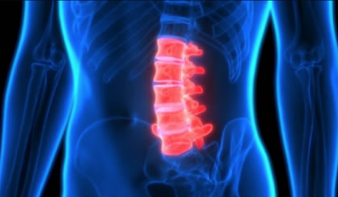 Convegno | Indicazioni e limiti degli  approcci anteriori al rachide lombare