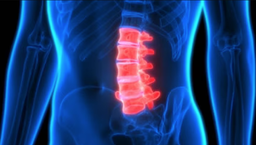Convegno | Indicazioni e limiti degli  approcci anteriori al rachide lombare