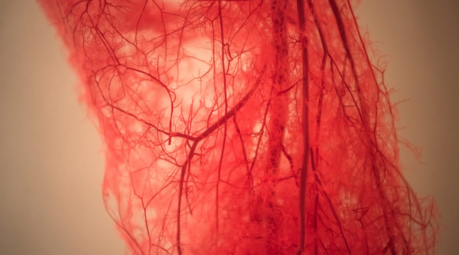 Casa di Cura BarbantiniL’insufficienza venosa e le sue complicanze