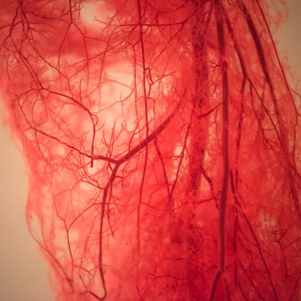 Casa di Cura BarbantiniL’insufficienza venosa e le sue complicanze